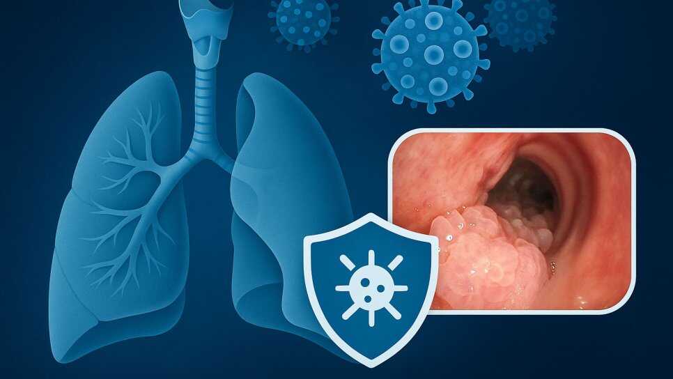 Is Your Voice Changing? Understanding Recurrent Respiratory Papillomatosis (RRP)